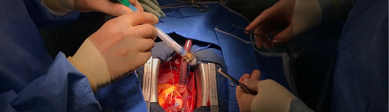 Mostaganem - Chirurgie vasculaire et cardiaque
